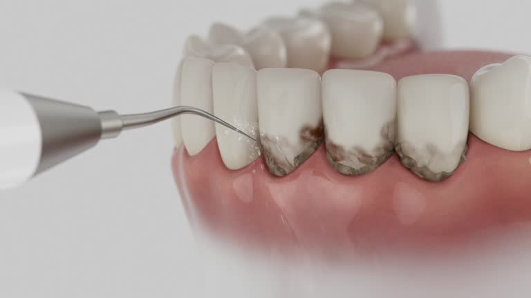 Trusted Dental Crowns And Bridges service in Madison, OH - Dentist Open Now